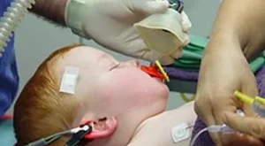 🩺 Çocuklarda Genel Anestezi: “Küçük Bedenler, Büyük Dikkat Gerektirir” 🩺 Çocuklarda Genel Anestezi: “Küçük Bedenler, Büyük Dikkat Gerektirir”