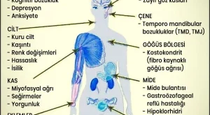 Fibromiyalji Hangi Durumlarda Kendini Gösterir Fibromiyalji Hangi Durumlarda Kendini Gösterir