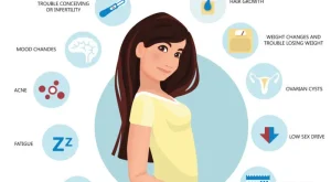 Polikistik Over Sendromu (PCOS) Polikistik Over Sendromu (PCOS)