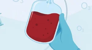 Ozon Tedavisi Nedir? Kimler İçin Uygundur ve Nasıl Uygulanır?